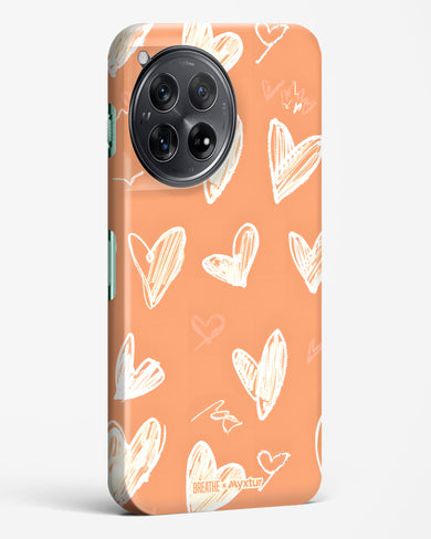 Miss You Already [BREATHE] Hard Case Phone Cover (OnePlus)