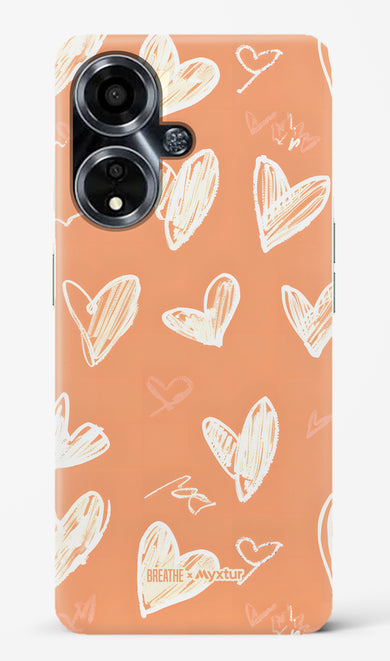 Miss You Already [BREATHE] Hard Case Phone Cover (Oppo)