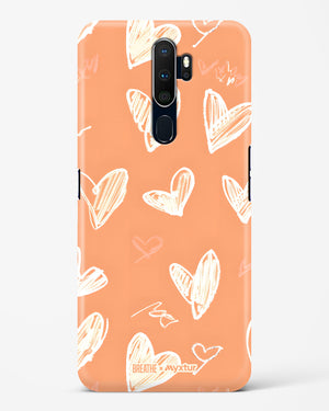 Miss You Already [BREATHE] Hard Case Phone Cover (Oppo)
