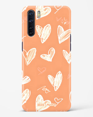 Miss You Already [BREATHE] Hard Case Phone Cover (Oppo)