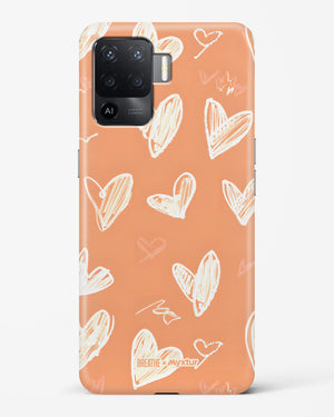 Miss You Already [BREATHE] Hard Case Phone Cover (Oppo)