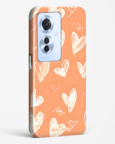 Miss You Already [BREATHE] Hard Case Phone Cover (Oppo)