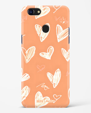 Miss You Already [BREATHE] Hard Case Phone Cover (Oppo)