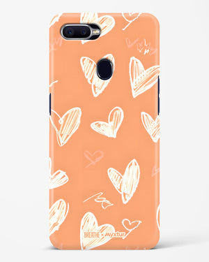 Miss You Already [BREATHE] Hard Case Phone Cover (Oppo)