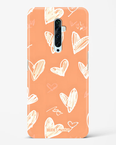 Miss You Already [BREATHE] Hard Case Phone Cover (Oppo)
