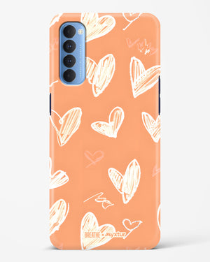 Miss You Already [BREATHE] Hard Case Phone Cover (Oppo)