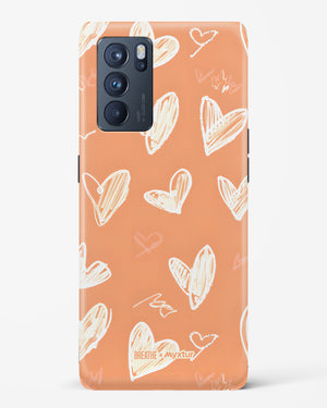 Miss You Already [BREATHE] Hard Case Phone Cover (Oppo)