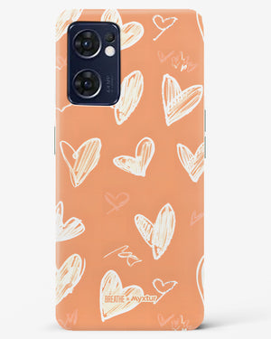 Miss You Already [BREATHE] Hard Case Phone Cover (Oppo)