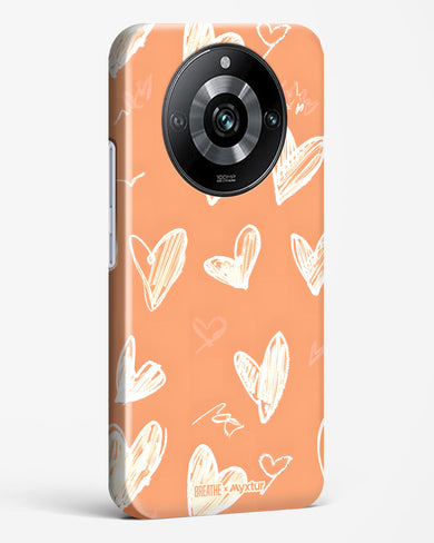 Miss You Already [BREATHE] Hard Case Phone Cover (Realme)