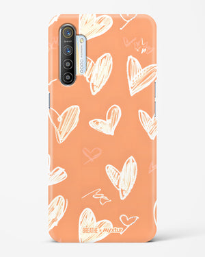 Miss You Already [BREATHE] Hard Case Phone Cover (Realme)