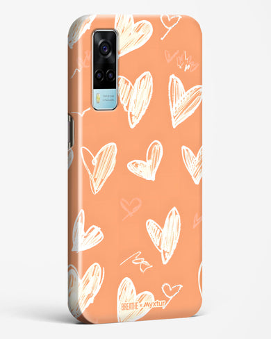 Miss You Already [BREATHE] Hard Case Phone Cover (Vivo)