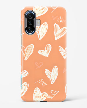 Miss You Already [BREATHE] Hard Case Phone Cover (Xiaomi)