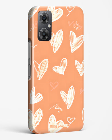 Miss You Already [BREATHE] Hard Case Phone Cover (Xiaomi)