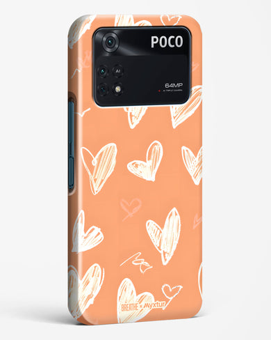 Miss You Already [BREATHE] Hard Case Phone Cover (Xiaomi)