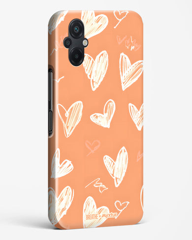 Miss You Already [BREATHE] Hard Case Phone Cover (Xiaomi)