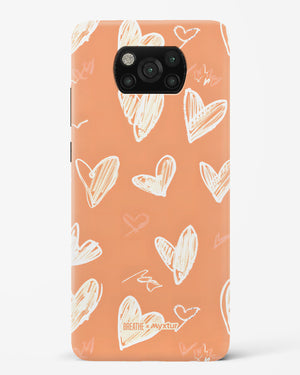 Miss You Already [BREATHE] Hard Case Phone Cover (Xiaomi)
