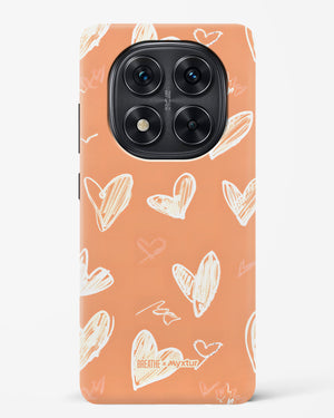 Miss You Already [BREATHE] Hard Case Phone Cover (Xiaomi)
