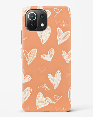Miss You Already [BREATHE] Hard Case Phone Cover (Xiaomi)