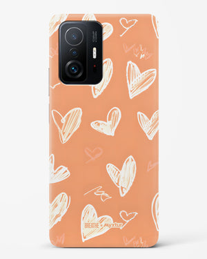 Miss You Already [BREATHE] Hard Case Phone Cover (Xiaomi)
