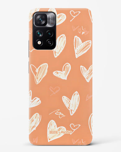 Miss You Already [BREATHE] Hard Case Phone Cover (Xiaomi)