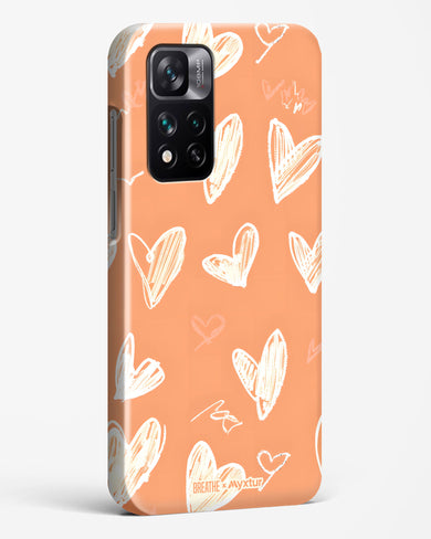 Miss You Already [BREATHE] Hard Case Phone Cover (Xiaomi)