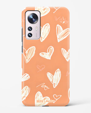 Miss You Already [BREATHE] Hard Case Phone Cover (Xiaomi)