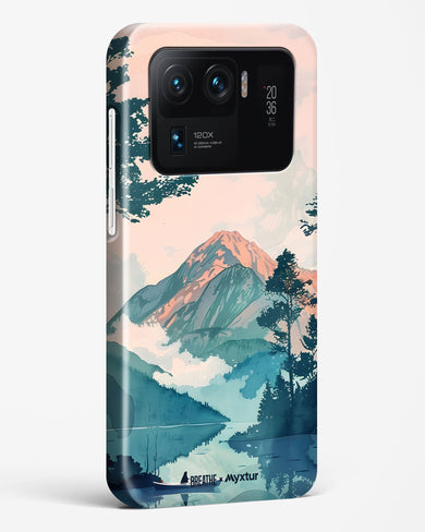 Placid Lake [BREATHE] Hard Case Phone Cover (Xiaomi)