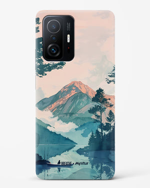 Placid Lake [BREATHE] Hard Case Phone Cover (Xiaomi)