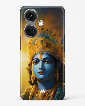 Enchanting Krishna Hard Case Phone Cover (OnePlus)