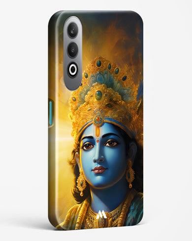 Enchanting Krishna Hard Case Phone Cover (OnePlus)