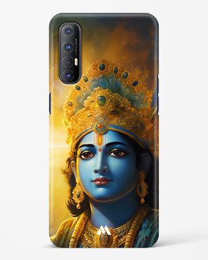 Enchanting Krishna Hard Case Phone Cover (Oppo)