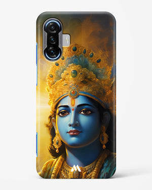 Enchanting Krishna Hard Case Phone Cover (Xiaomi)