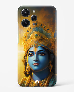 Enchanting Krishna Hard Case Phone Cover (Xiaomi)