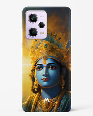 Enchanting Krishna Hard Case Phone Cover (Xiaomi)