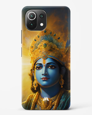 Enchanting Krishna Hard Case Phone Cover (Xiaomi)