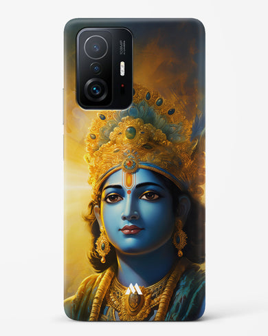 Enchanting Krishna Hard Case Phone Cover (Xiaomi)