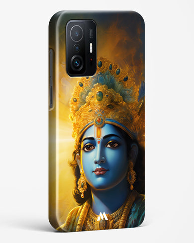 Enchanting Krishna Hard Case Phone Cover (Xiaomi)