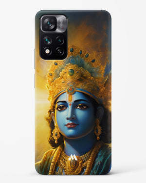 Enchanting Krishna Hard Case Phone Cover (Xiaomi)