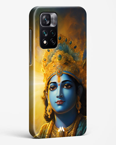 Enchanting Krishna Hard Case Phone Cover (Xiaomi)
