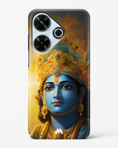 Enchanting Krishna Hard Case Phone Cover (Xiaomi)