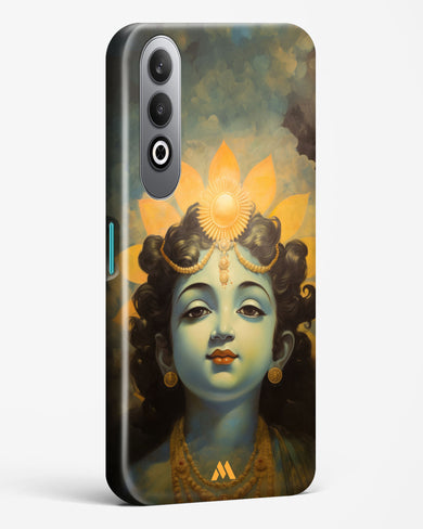Krishna Serenade Hard Case Phone Cover (OnePlus)