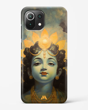 Krishna Serenade Hard Case Phone Cover (Xiaomi)