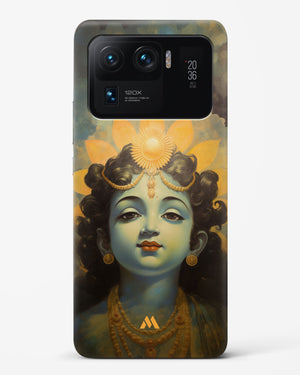 Krishna Serenade Hard Case Phone Cover (Xiaomi)