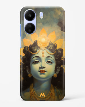 Krishna Serenade Hard Case Phone Cover (Xiaomi)