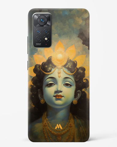 Krishna Serenade Hard Case Phone Cover (Xiaomi)