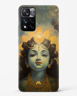 Krishna Serenade Hard Case Phone Cover (Xiaomi)