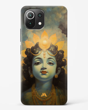 Krishna Serenade Hard Case Phone Cover (Xiaomi)