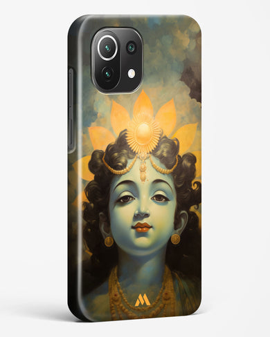 Krishna Serenade Hard Case Phone Cover (Xiaomi)