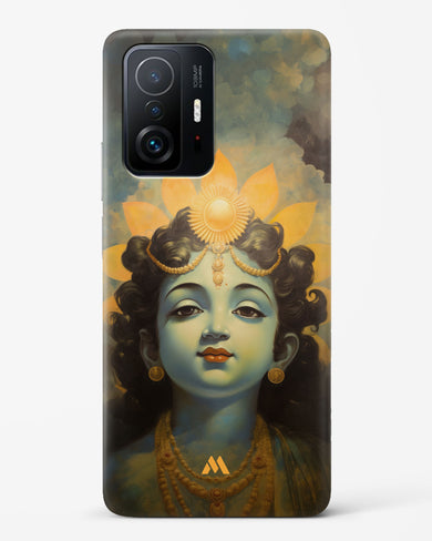 Krishna Serenade Hard Case Phone Cover (Xiaomi)