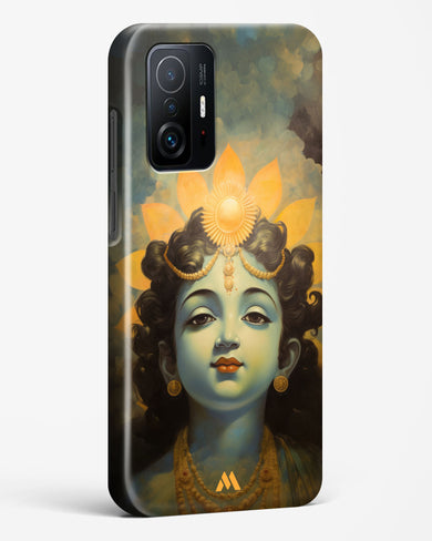 Krishna Serenade Hard Case Phone Cover (Xiaomi)